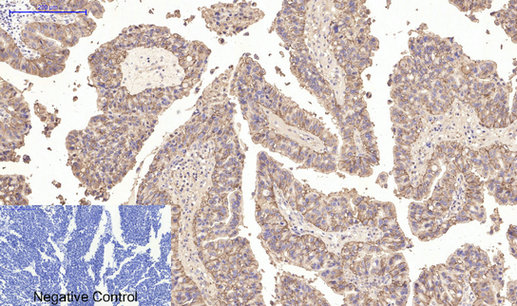 Carbonic Anhydrase IX Mouse Monoclonal Antibody