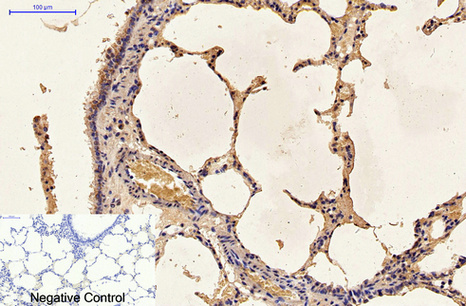 Caspase 9 Mouse Monoclonal Antibody