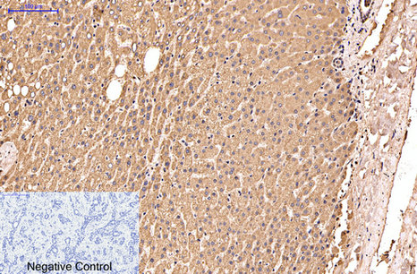 Insulin Degrading Enzyme Mouse Monoclonal Antibody