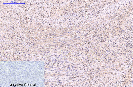 EFHD1 Mouse Monoclonal Antibody