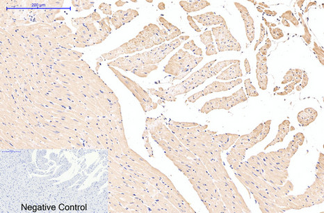 EFHD1 Mouse Monoclonal Antibody