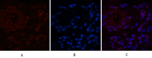 NFκB p65 Mouse Monoclonal Antibody