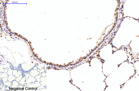 NFκB p65 Mouse Monoclonal Antibody