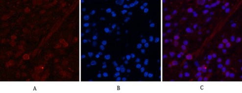 Peroxiredoxin 1 Mouse Monoclonal Antibody