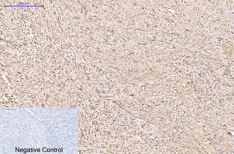 Peroxiredoxin 1 Mouse Monoclonal Antibody