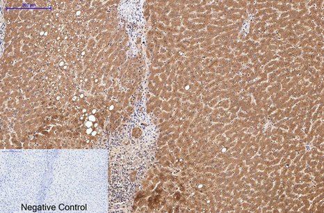 Collagen III Mouse Monoclonal Antibody(Q76)