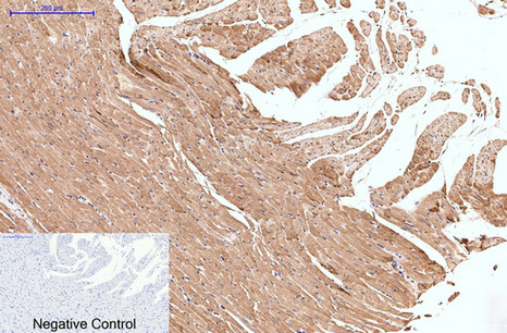 Collagen III Mouse Monoclonal Antibody(Q76)