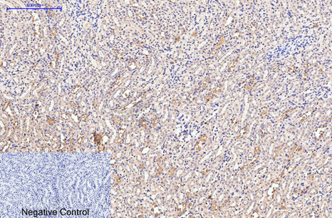 Collagen III Mouse Monoclonal Antibody(Q76)