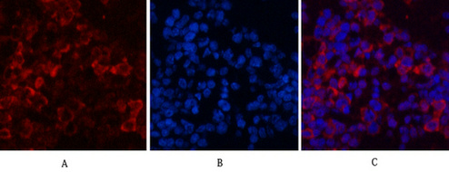 eIF4A1 Mouse Monoclonal Antibody