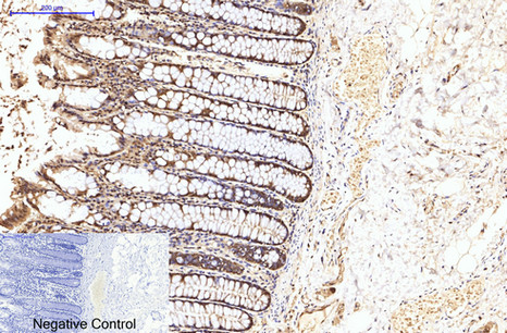 eIF4A1 Mouse Monoclonal Antibody