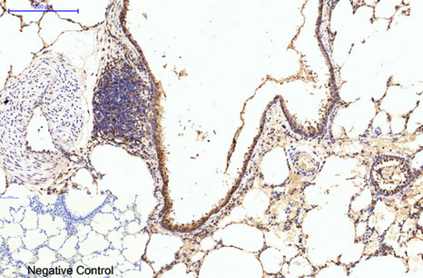 eIF4A1 Mouse Monoclonal Antibody