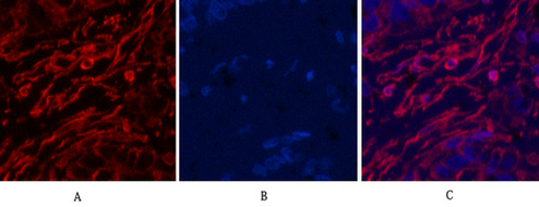 α Skeletal Muslce Actin Mouse Monoclonal Antibody(4B11)