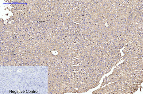 α Skeletal Muslce Actin Mouse Monoclonal Antibody(4B11)