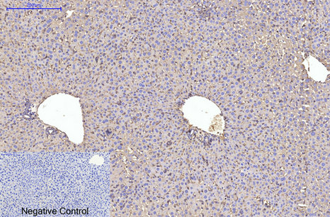 α Skeletal Muslce Actin Mouse Monoclonal Antibody(4B11)