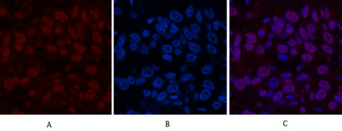 Transferrin Mouse Monoclonal Antibody(7F4)