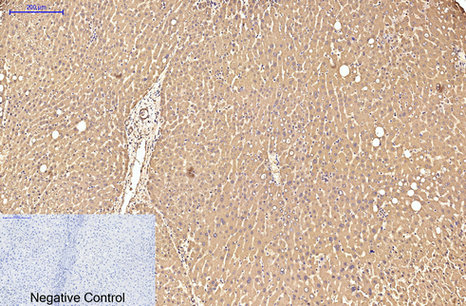 Transferrin Mouse Monoclonal Antibody(7F4)