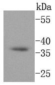 CD68 Rabbit mAb