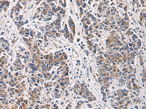 HSDL2 antibody