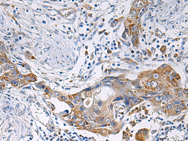 HSDL2 antibody