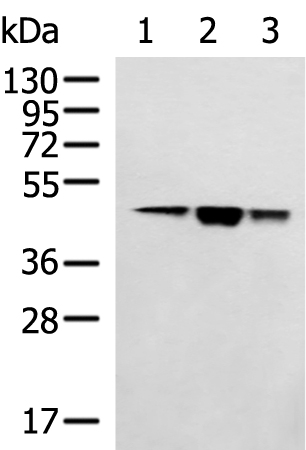 HSDL2 antibody