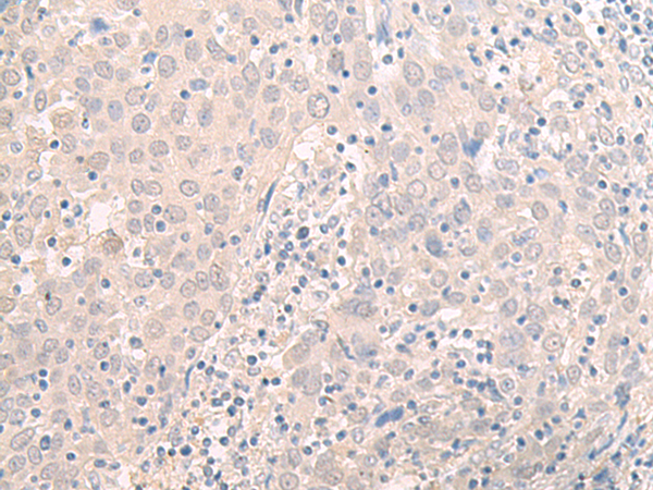 HOOK2 antibody