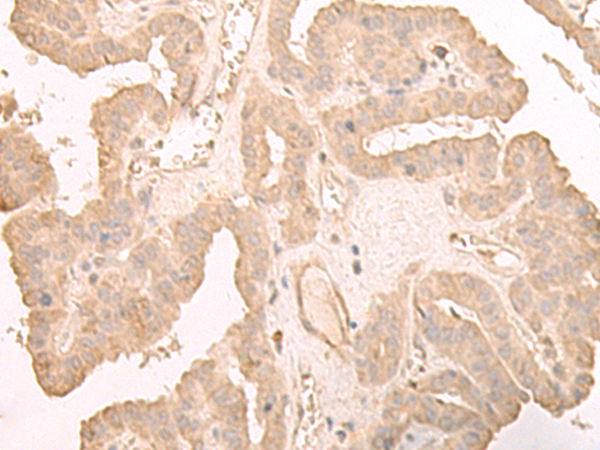 HOOK2 antibody