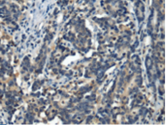 SSTR5 Antibody