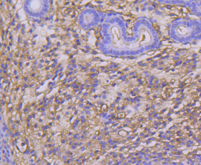 TWEAKR Rabbit mAb