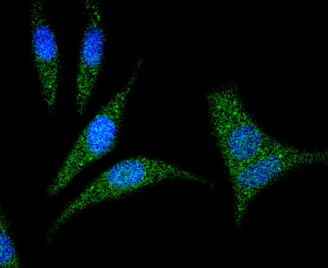 RhoA Rabbit mAb