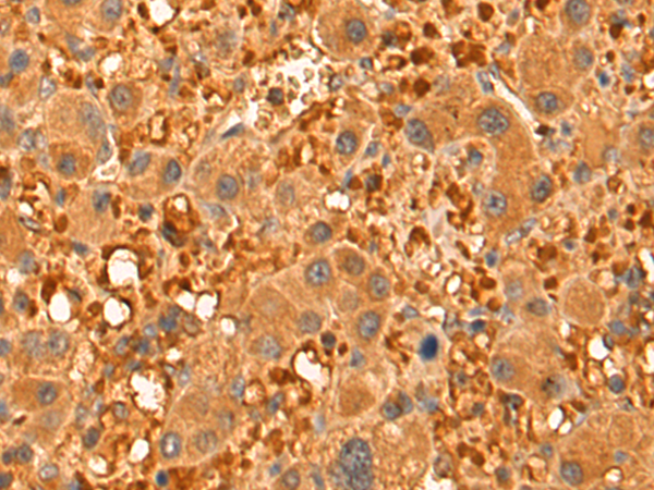 CCL17 Antibody