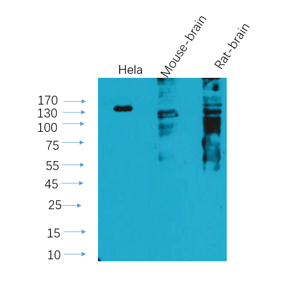 GPR116 Polyclonal Antibody