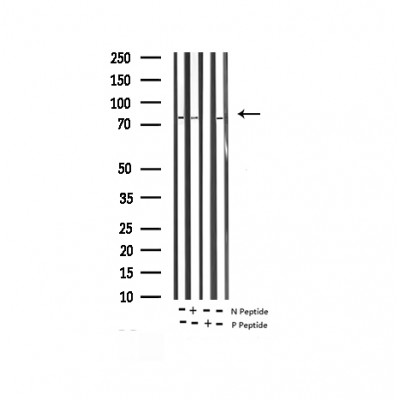 B-RAF (Phospho-Thr599) Antibody