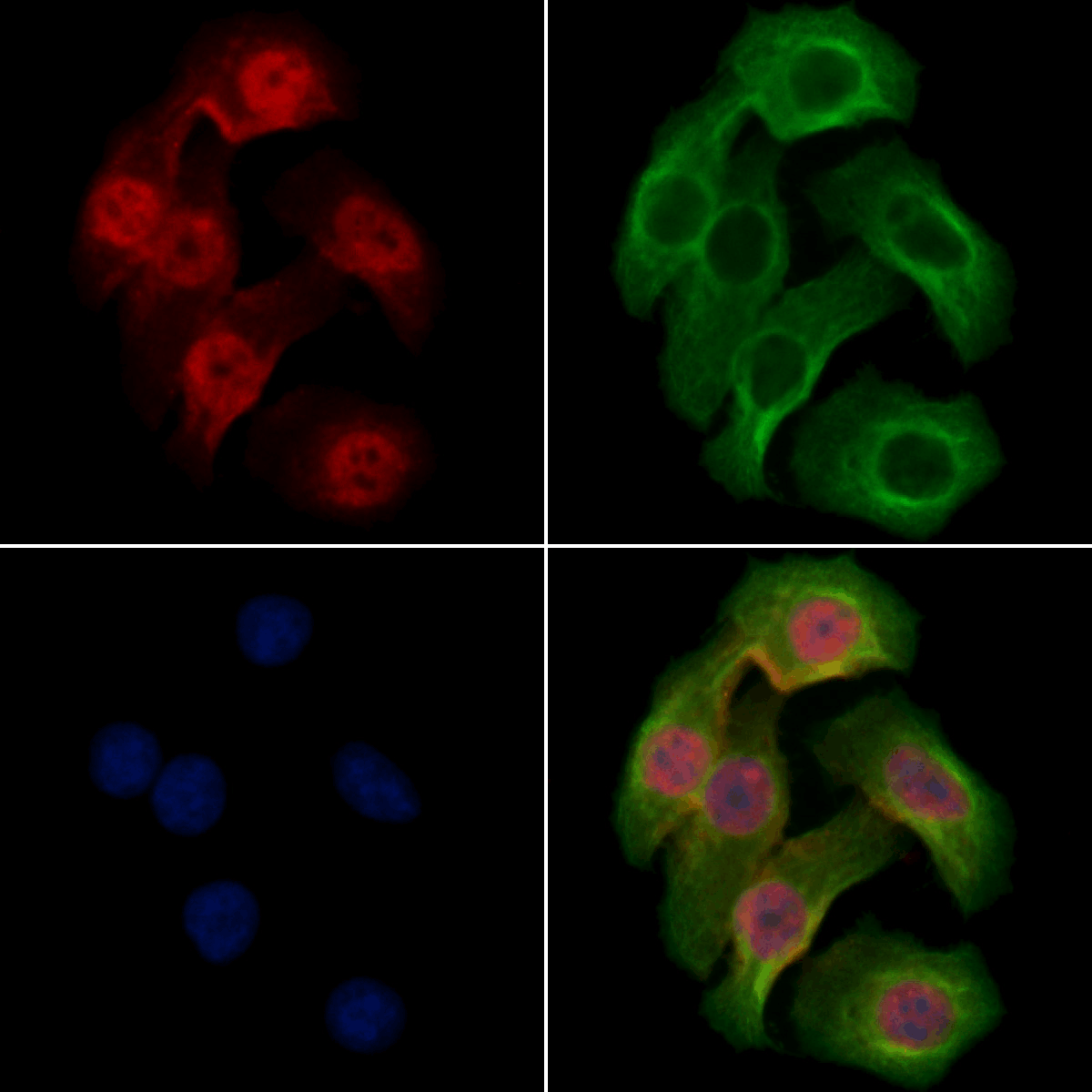 Retinoblastoma (Phospho-Ser608) Antibody