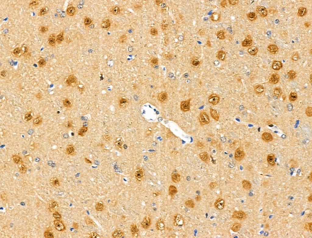 Retinoblastoma (Phospho-Ser608) Antibody