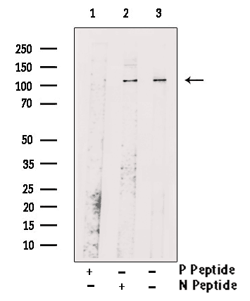 Retinoblastoma (Phospho-Ser608) Antibody