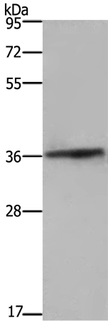 FCAR Antibody