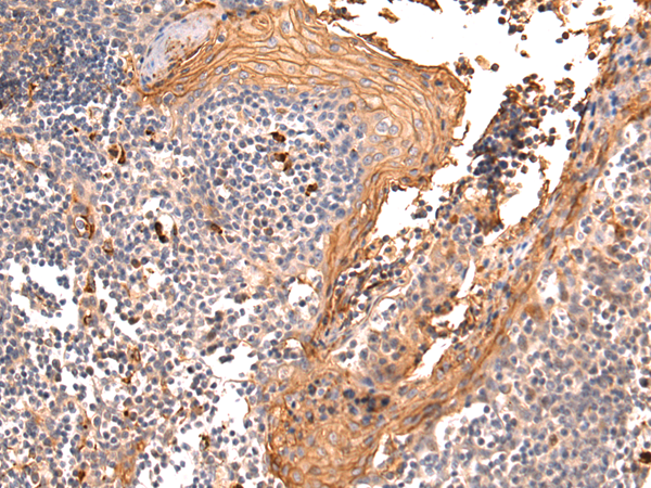 CEACAM8 Antibody