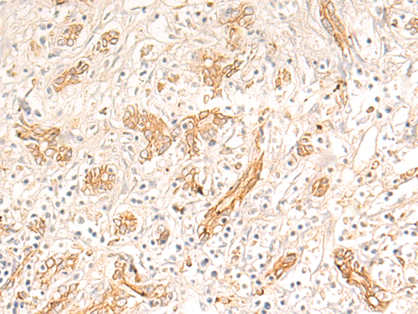 FGL2 Antibody