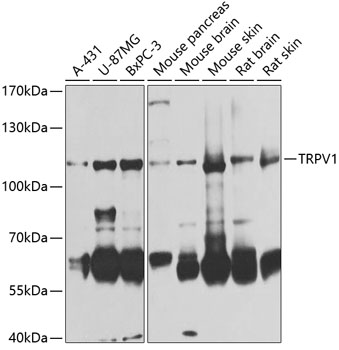 TRPV1 Rabbit Polyclonal Antibody