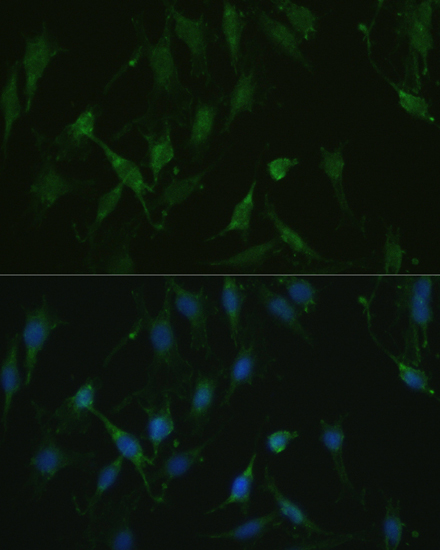 TRPV1 Rabbit Polyclonal Antibody