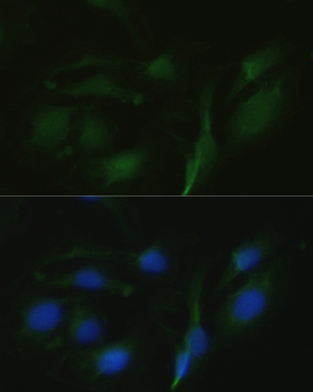 TRPV1 Rabbit Polyclonal Antibody