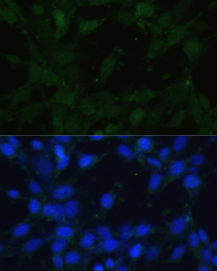 TRPV1 Rabbit Polyclonal Antibody