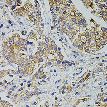 TRPA1 Rabbit Polyclonal Antibody