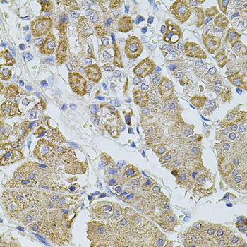 TRPA1 Rabbit Polyclonal Antibody