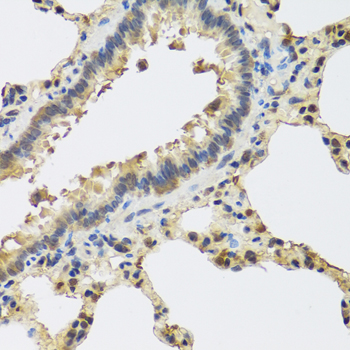 IL25 Polyclonal Antibody