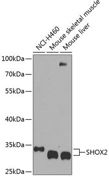 SHOX2 Polyclonal Antibody