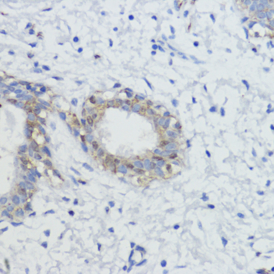 pan-AKT antibody