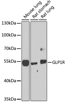 GLP1R Rabbit Polyclonal Antibody