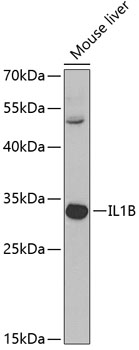 IL1B Antibody