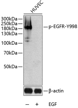 EGFR(Phospho-Tyr998) antibody